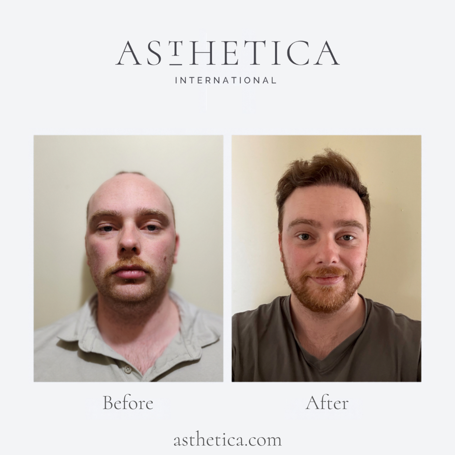 Winner small image - Asthetica Intl.