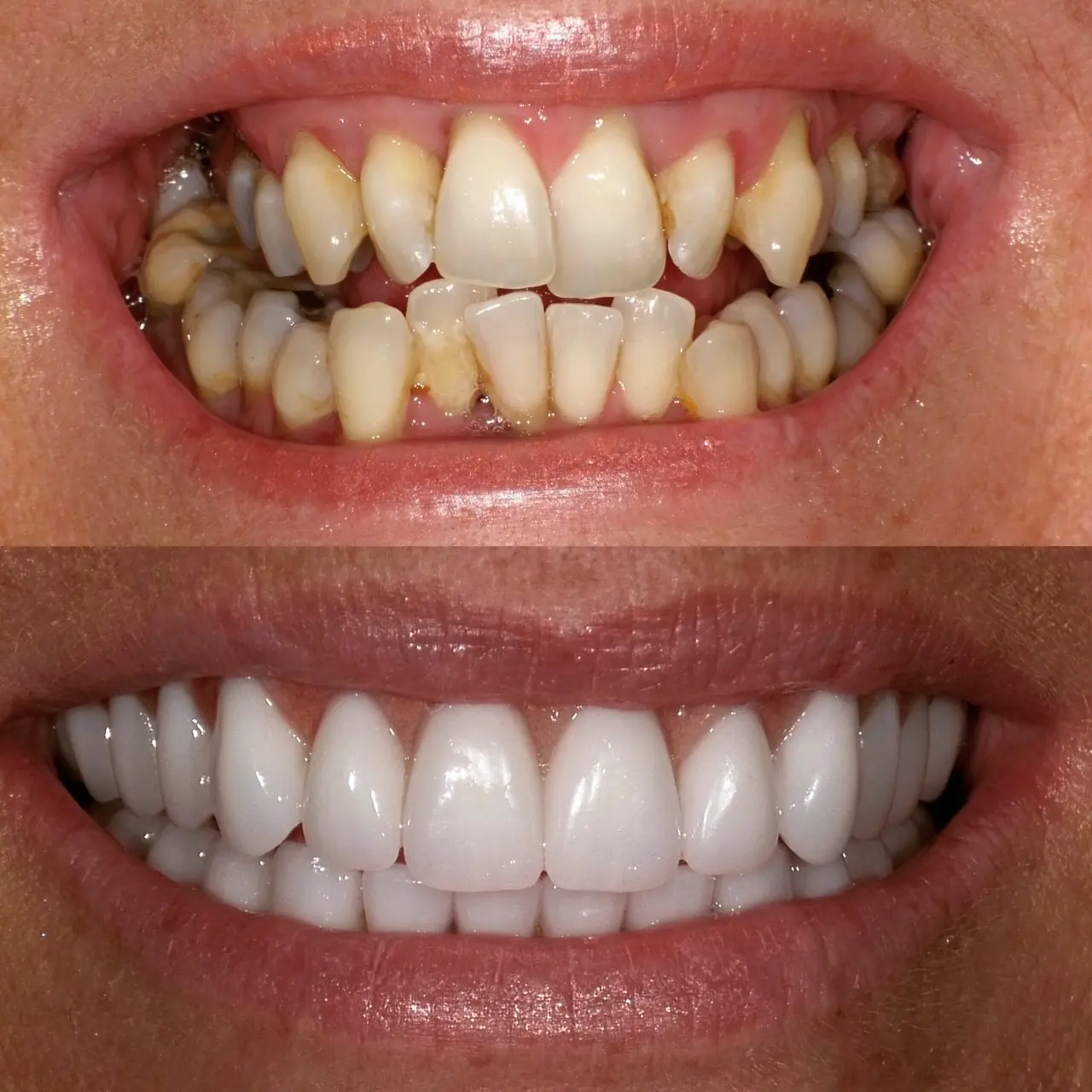 Winner small image - Fusion Dentistry